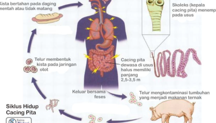 Spesies Cacing Pita Menimbulkan Banyak Masalah Pada Tubuh