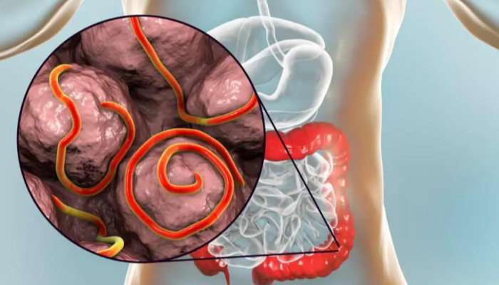 Terinfeksi Cacing Menjadi Masalah Yang Sangat Mengganggu