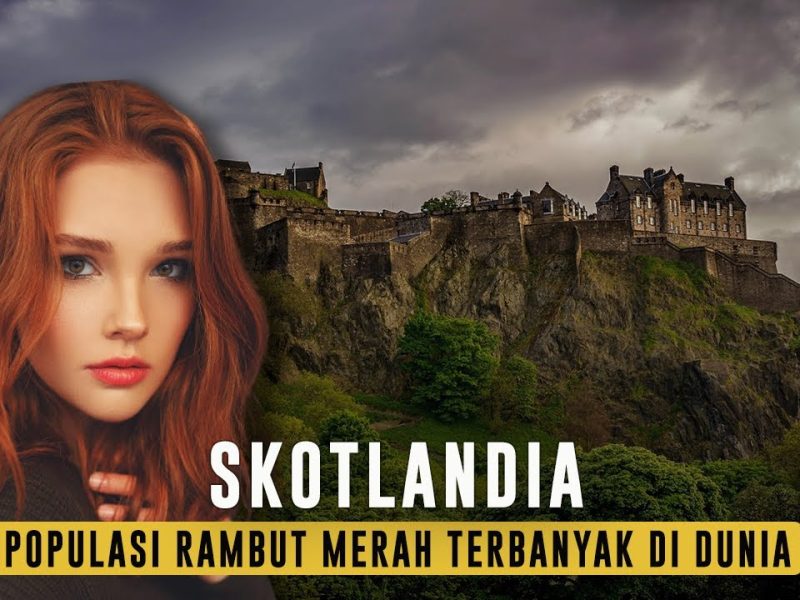 Keunikan Populasi Di Skotlandia Dan Rambut Merah Yang Khas