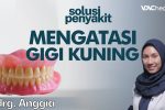 Kondisi Gigi Kuning