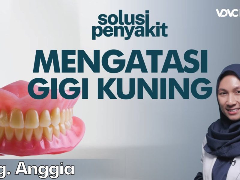 Kondisi Gigi Kuning Bikin Kurang Percaya Diri? Kenali Faktanya