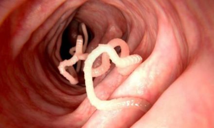 Cara Mengeluarkan Parasit Dalam Tubuh Secara Alami