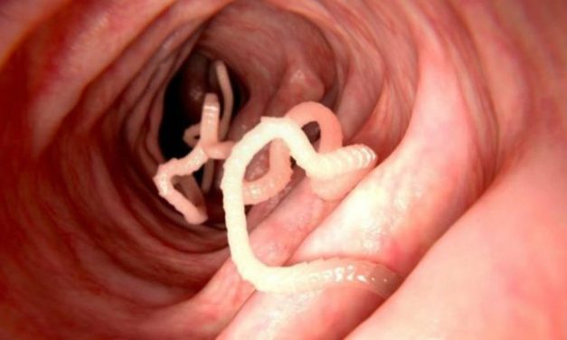 Cara Mengeluarkan Parasit Dalam Tubuh Secara Alami