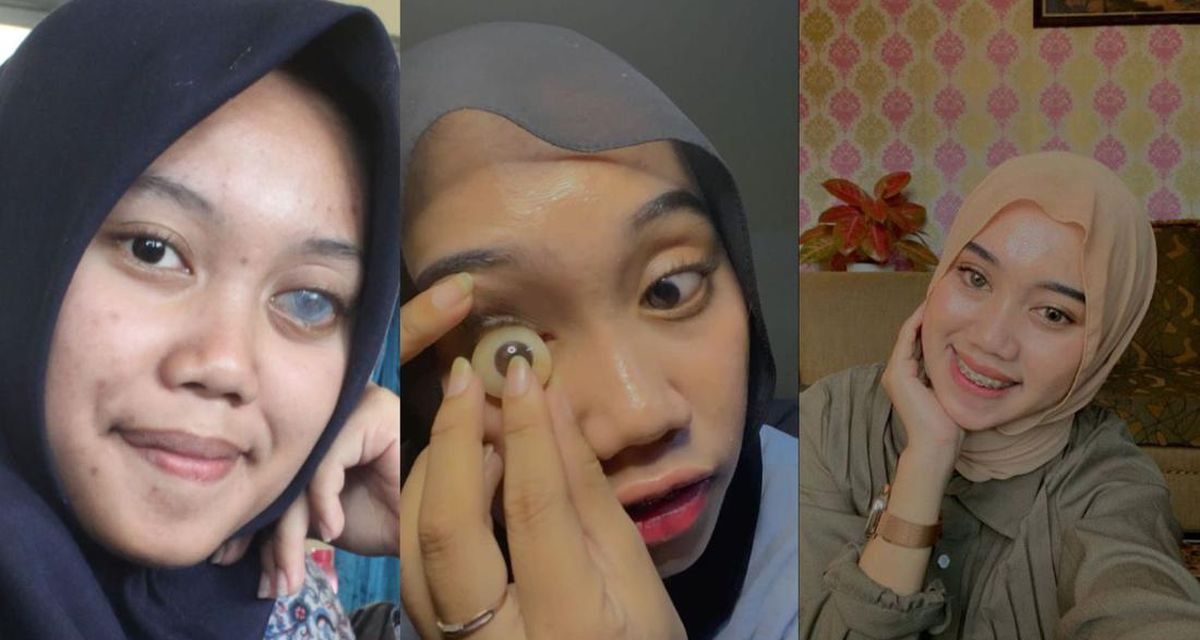 Protesa Mata Ternyata Juga Memiliki Risiko Buruk, Ketahui Yuk!