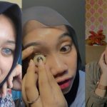 Protesa Mata Ternyata Juga Memiliki Risiko Buruk, Ketahui Yuk!
