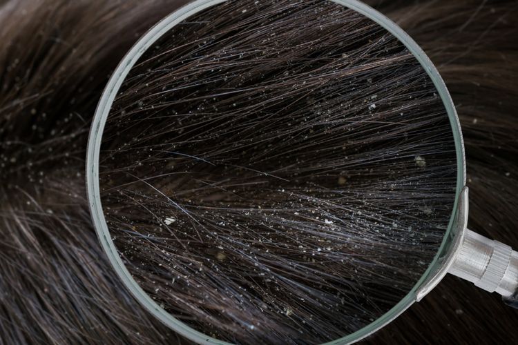 Rambut Berketombe